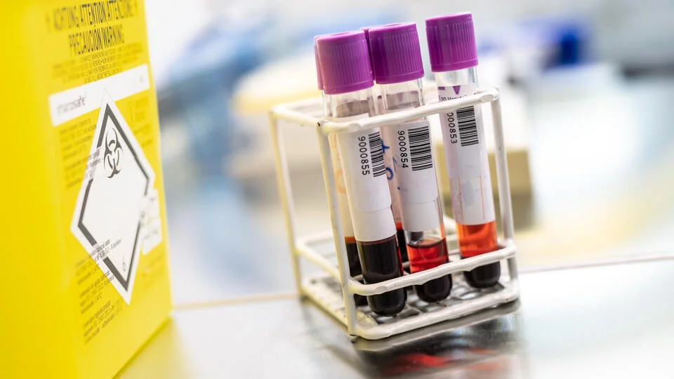 300-dən çox ölümcül virus nümunəsi itdi